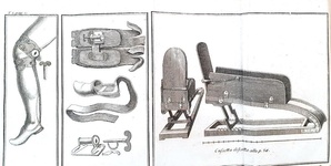 Petit - Trattato de' mali dell'ossa - Napoli 1775 (prima edizione italiana - con 5 bellissime tavole
